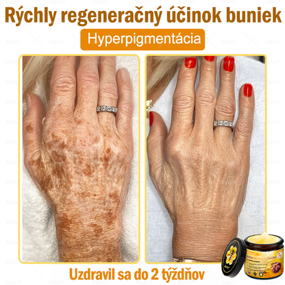 🌻🌻 Sinvie® Krém na obnovu pokožky s včelím jedom 🔥 Odporúčané dermatológmi | Proti vráskam, pigmentovým škvrnám a ochabnutej pokožke – 50 ml
