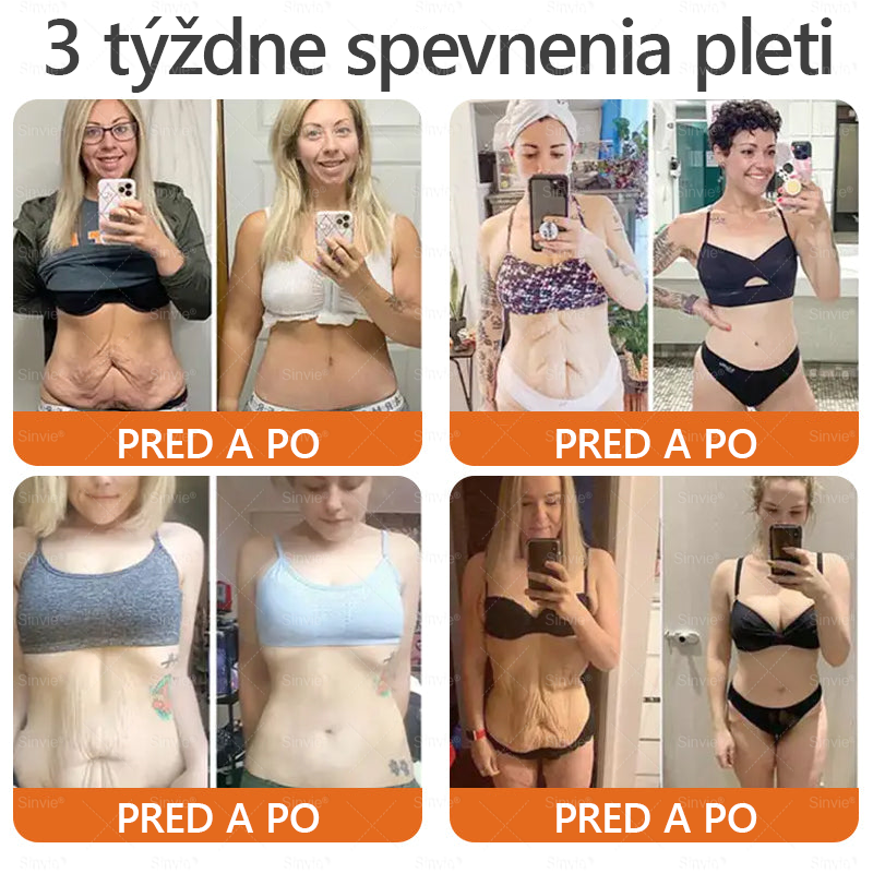 🌻🌻 Sinvie® Krém na obnovu pokožky s včelím jedom 🔥 Odporúčané dermatológmi | Proti vráskam, pigmentovým škvrnám a ochabnutej pokožke – 50 ml