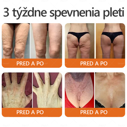 🌻🌻 Sinvie® Krém na obnovu pokožky s včelím jedom 🔥 Odporúčané dermatológmi | Proti vráskam, pigmentovým škvrnám a ochabnutej pokožke – 50 ml