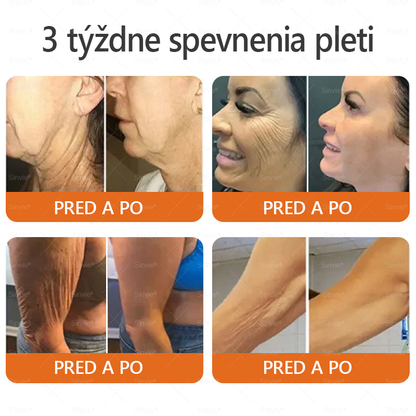 🌻🌻 Sinvie® Krém na obnovu pokožky s včelím jedom 🔥 Odporúčané dermatológmi | Proti vráskam, pigmentovým škvrnám a ochabnutej pokožke – 50 ml