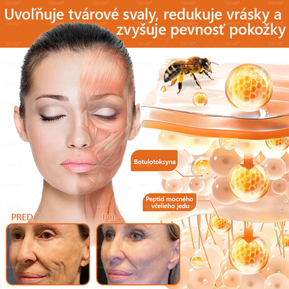 🌻🌻 Sinvie® Krém na obnovu pokožky s včelím jedom 🔥 Odporúčané dermatológmi | Proti vráskam, pigmentovým škvrnám a ochabnutej pokožke – 50 ml
