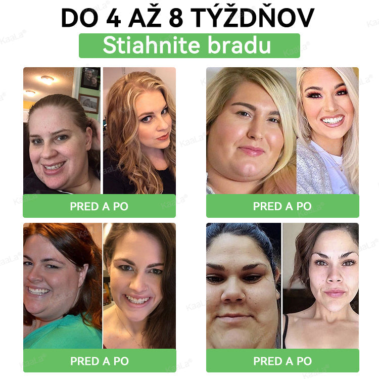 🫧🫧𝐊𝐚𝐚𝐋𝐚® 𝐆𝐋𝐏-𝟏 𝟖-𝐯-𝟏 𝐅𝐢𝐭 & 𝐕𝐢𝐭𝐚𝐥 𝐏𝐞𝐫𝐨𝐫á𝐥𝐧𝐲 𝐑𝐨𝐳𝐭𝐨𝐤 ✅ (𝐋𝐞𝐧 𝐫𝐚𝐳 𝐝𝐞𝐧𝐧𝐞, 𝐯𝐢𝐝𝐢𝐭𝐞ľ𝐧é 𝐳𝐦𝐞𝐧𝐲 𝐮ž 𝐳𝐚 𝟕 𝐝𝐧í) 𝐏𝐫𝐞 𝐨𝐛𝐞𝐳𝐢𝐭𝐮, 𝐤𝐚𝐫𝐝𝐢𝐨𝐯𝐚𝐬𝐤𝐮𝐥á𝐫𝐧𝐞 𝐨𝐜𝐡𝐨𝐫𝐞𝐧𝐢𝐚, 𝐜𝐮𝐤𝐫𝐨𝐯𝐤𝐮, 𝐬𝐩á𝐧𝐤𝐨𝐯é 𝐚𝐩𝐧𝐨𝐞, 𝐳𝐝𝐫𝐚𝐯𝐢𝐞 č𝐫𝐢𝐞𝐯, 𝐩𝐫𝐨𝐛𝐥é𝐦𝐲 𝐬 𝐤ĺ𝐛𝐦𝐢 𝐚 ď𝐚𝐥š𝐢𝐞