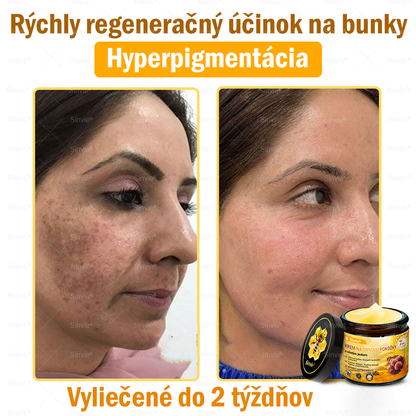 🌻🌻 Sinvie® Krém na obnovu pokožky s včelím jedom 🔥 Odporúčané dermatológmi | Proti vráskam, pigmentovým škvrnám a ochabnutej pokožke – 50 ml