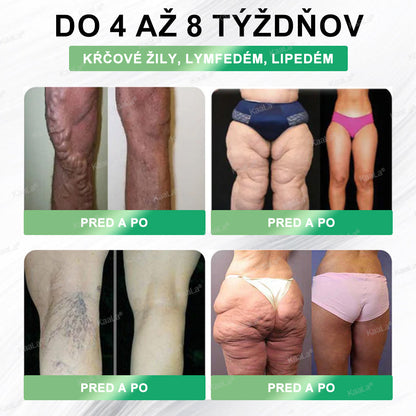 🫧🫧𝐊𝐚𝐚𝐋𝐚® 𝐆𝐋𝐏-𝟏 𝟖-𝐯-𝟏 𝐅𝐢𝐭 & 𝐕𝐢𝐭𝐚𝐥 𝐏𝐞𝐫𝐨𝐫á𝐥𝐧𝐲 𝐑𝐨𝐳𝐭𝐨𝐤 ✅ (𝐋𝐞𝐧 𝐫𝐚𝐳 𝐝𝐞𝐧𝐧𝐞, 𝐯𝐢𝐝𝐢𝐭𝐞ľ𝐧é 𝐳𝐦𝐞𝐧𝐲 𝐮ž 𝐳𝐚 𝟕 𝐝𝐧í) 𝐏𝐫𝐞 𝐨𝐛𝐞𝐳𝐢𝐭𝐮, 𝐤𝐚𝐫𝐝𝐢𝐨𝐯𝐚𝐬𝐤𝐮𝐥á𝐫𝐧𝐞 𝐨𝐜𝐡𝐨𝐫𝐞𝐧𝐢𝐚, 𝐜𝐮𝐤𝐫𝐨𝐯𝐤𝐮, 𝐬𝐩á𝐧𝐤𝐨𝐯é 𝐚𝐩𝐧𝐨𝐞, 𝐳𝐝𝐫𝐚𝐯𝐢𝐞 č𝐫𝐢𝐞𝐯, 𝐩𝐫𝐨𝐛𝐥é𝐦𝐲 𝐬 𝐤ĺ𝐛𝐦𝐢 𝐚 ď𝐚𝐥š𝐢𝐞