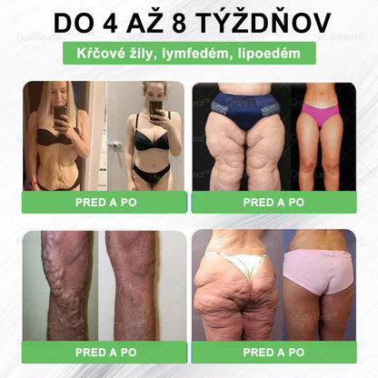 SVKBuildLeaf® GLP-1 6-v-1 Health Solution Perorálna tekutina (Len raz denne, viditeľné zmeny už za 7 dní) Pre obezitu, kardiovaskulárne ochorenia, cukrovku, spánkové apnoe, zdravie čriev, problémy s kĺbmi a ďalšie